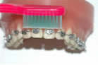 Higiene Bucal con Ortodoncia